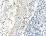 COL8A1 Antibody in Immunohistochemistry (Paraffin) (IHC (P))