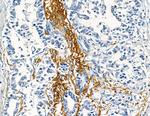 COL8A1 Antibody in Immunohistochemistry (Paraffin) (IHC (P))