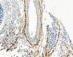 COL8A1 Antibody in Immunohistochemistry (Paraffin) (IHC (P))