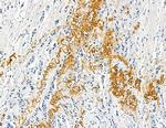 COL8A1 Antibody in Immunohistochemistry (Paraffin) (IHC (P))