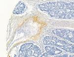 COL8A1 Antibody in Immunohistochemistry (Paraffin) (IHC (P))