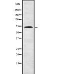 COL8A1 Antibody in Western Blot (WB)