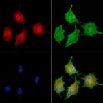 CYP4F3 Antibody in Immunocytochemistry (ICC/IF)