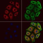 CALY Antibody in Immunocytochemistry (ICC/IF)