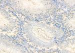 CALY Antibody in Immunohistochemistry (Paraffin) (IHC (P))