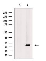 CALY Antibody in Western Blot (WB)