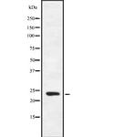 FGF16 Antibody in Western Blot (WB)