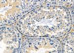 FGF20 Antibody in Immunohistochemistry (Paraffin) (IHC (P))