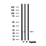 FGF20 Antibody in Western Blot (WB)