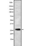 FGFBP3 Antibody in Western Blot (WB)