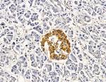 GTSE1 Antibody in Immunohistochemistry (Paraffin) (IHC (P))