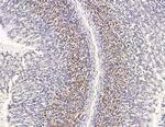 GTSE1 Antibody in Immunohistochemistry (Paraffin) (IHC (P))