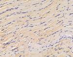 GTSE1 Antibody in Immunohistochemistry (Paraffin) (IHC (P))