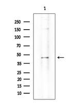 IFI44 Antibody in Western Blot (WB)