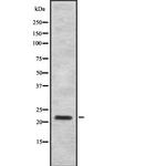 IFNA7/IFNA16 Antibody in Western Blot (WB)