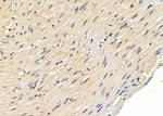 KDM5A Antibody in Immunohistochemistry (Paraffin) (IHC (P))