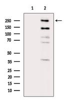 KDM5A Antibody in Western Blot (WB)