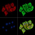 KRT3/6A/75/76 Antibody in Immunocytochemistry (ICC/IF)