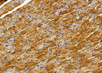 KRT3/6A/75/76 Antibody in Immunohistochemistry (Paraffin) (IHC (P))