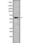 KRT3/6A/75/76 Antibody in Western Blot (WB)