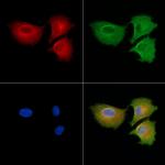 MYL6B Antibody in Immunocytochemistry (ICC/IF)