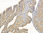 MYL6B Antibody in Immunohistochemistry (Paraffin) (IHC (P))