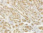 MYL6B Antibody in Immunohistochemistry (Paraffin) (IHC (P))