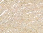 MYL6B Antibody in Immunohistochemistry (Paraffin) (IHC (P))