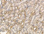 MYL6B Antibody in Immunohistochemistry (Paraffin) (IHC (P))