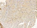 MYL6B Antibody in Immunohistochemistry (Paraffin) (IHC (P))