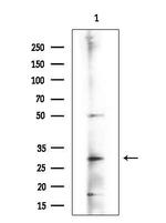 MYL6B Antibody in Western Blot (WB)