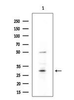 MYL6B Antibody in Western Blot (WB)