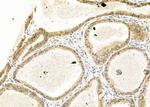 MOZ Antibody in Immunohistochemistry (Paraffin) (IHC (P))