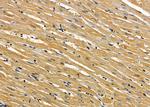 TUBE1 Antibody in Immunohistochemistry (Paraffin) (IHC (P))