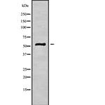 TUBE1 Antibody in Western Blot (WB)