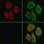 Laminin gamma-2 Antibody in Immunocytochemistry (ICC/IF)