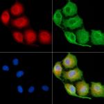 EDAR Antibody in Immunocytochemistry (ICC/IF)