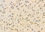 CENPC Antibody in Immunohistochemistry (Paraffin) (IHC (P))