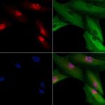 CENPH Antibody in Immunocytochemistry (ICC/IF)