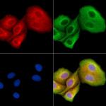 HUS1B Antibody in Immunocytochemistry (ICC/IF)