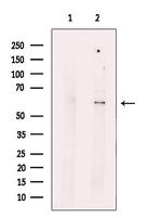 LPCAT4 Antibody in Western Blot (WB)