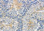 RPL38 Antibody in Immunohistochemistry (Paraffin) (IHC (P))