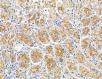 INPP5E Antibody in Immunohistochemistry (Paraffin) (IHC (P))