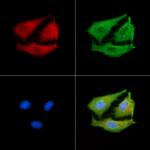 ACAD9 Antibody in Immunocytochemistry (ICC/IF)