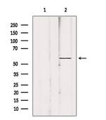 ACBD5 Antibody in Western Blot (WB)