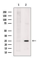 LYPLA2 Antibody in Western Blot (WB)