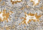 ASAH3 Antibody in Immunohistochemistry (Paraffin) (IHC (P))