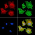 Alsin Antibody in Immunocytochemistry (ICC/IF)