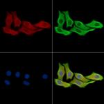 AMPD3 Antibody in Immunocytochemistry (ICC/IF)