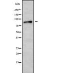 AMPD3 Antibody in Western Blot (WB)